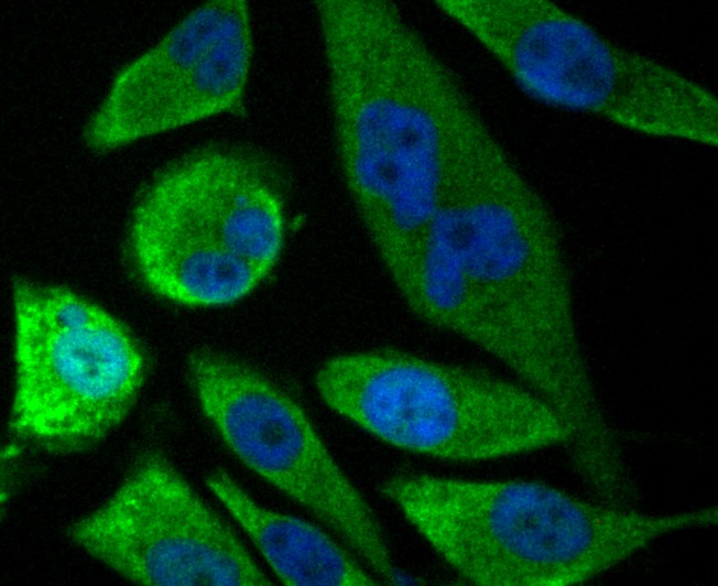 ICC staining SOCS2 in SH-SY-5Y cells (green). The nuclear counter stain is DAPI (blue). Cells were fixed in paraformaldehyde, permeabilised with 0.25% Triton X100/PBS.
