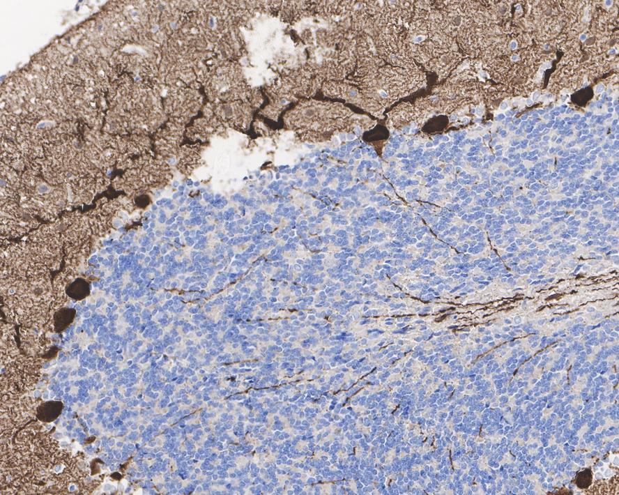 Immunohistochemical analysis of paraffin-embedded rat cerebellum tissue with Rabbit anti-PKC gamma antibody (ET7108-42) at 1/1,000 dilution.<br />
<br />
The section was pre-treated using heat mediated antigen retrieval with Tris-EDTA buffer (pH 9.0) for 20 minutes. The tissues were blocked in 1% BSA for 20 minutes at room temperature, washed with ddH2O and PBS, and then probed with the primary antibody (ET7108-42) at 1/1,000 dilution for 1 hour at room temperature. The detection was performed using an HRP conjugated compact polymer system. DAB was used as the chromogen. Tissues were counterstained with hematoxylin and mounted with DPX.