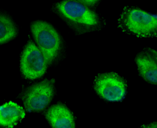 ICC staining of Mib1 in SH-SY5Y cells (green). Formalin fixed cells were permeabilized with 0.1% Triton X-100 in TBS for 10 minutes at room temperature and blocked with 10% negative goat serum for 15 minutes at room temperature. Cells were probed with the primary antibody (ET7108-43, 1/50) for 1 hour at room temperature, washed with PBS. Alexa Fluor®488 conjugate-Goat anti-Rabbit IgG was used as the secondary antibody at 1/1,000 dilution. The nuclear counter stain is DAPI (blue).