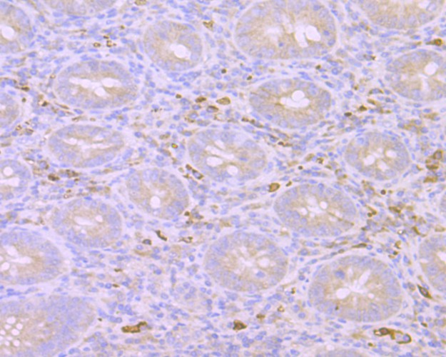 Immunohistochemical analysis of paraffin-embedded human kidney tissue using anti-Mib1 antibody. The section was pre-treated using heat mediated antigen retrieval with Tris-EDTA buffer (pH 9.0) for 20 minutes.The tissues were blocked in 1% BSA for 30 minutes at room temperature, washed with ddH2O and PBS, and then probed with the primary antibody (ET7108-43, 1/50) for 30 minutes at room temperature. The detection was performed using an HRP conjugated compact polymer system. DAB was used as the chromogen. Tissues were counterstained with hematoxylin and mounted with DPX.