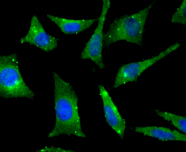 ICC staining of RHEB in SH-SY5Y cells (green). Formalin fixed cells were permeabilized with 0.1% Triton X-100 in TBS for 10 minutes at room temperature and blocked with 1% Blocker BSA for 15 minutes at room temperature. Cells were probed with the primary antibody (ET7108-44, 1/50) for 1 hour at room temperature, washed with PBS. Alexa Fluor®488 Goat anti-Rabbit IgG was used as the secondary antibody at 1/1,000 dilution. The nuclear counter stain is DAPI (blue).
