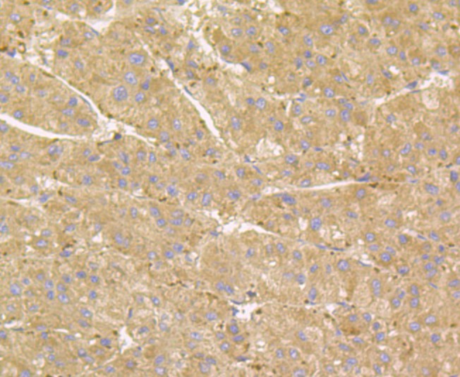 Immunohistochemical analysis of paraffin-embedded human liver tissue using anti-RHEB antibody. The section was pre-treated using heat mediated antigen retrieval with Tris-EDTA buffer (pH 8.0-8.4) for 20 minutes.The tissues were blocked in 5% BSA for 30 minutes at room temperature, washed with ddH2O and PBS, and then probed with the primary antibody (ET7108-44, 1/50) for 30 minutes at room temperature. The detection was performed using an HRP conjugated compact polymer system. DAB was used as the chromogen. Tissues were counterstained with hematoxylin and mounted with DPX.