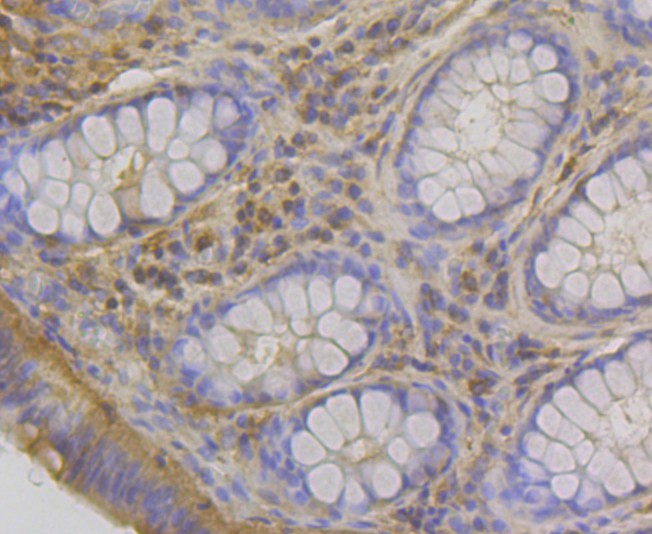 Immunohistochemical analysis of paraffin-embedded human colon tissue using anti-RHEB antibody. The section was pre-treated using heat mediated antigen retrieval with Tris-EDTA buffer (pH 8.0-8.4) for 20 minutes.The tissues were blocked in 5% BSA for 30 minutes at room temperature, washed with ddH2O and PBS, and then probed with the primary antibody (ET7108-44, 1/50) for 30 minutes at room temperature. The detection was performed using an HRP conjugated compact polymer system. DAB was used as the chromogen. Tissues were counterstained with hematoxylin and mounted with DPX.
