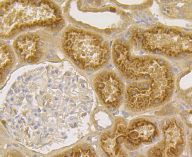 Immunohistochemical analysis of paraffin-embedded  human kidney tissue with Rabbit anti-Tetranectin antibody (ET7108-45) at 1/50 dilution.<br />
<br />
The section was pre-treated using heat mediated antigen retrieval with Tris-EDTA buffer (pH 9.0) for 20 minutes. The tissues were blocked in 1% BSA for 20 minutes at room temperature, washed with ddH2O and PBS, and then probed with the primary antibody (ET7108-45) at 1/50 dilution for 0.5 hour at room temperature. The detection was performed using an HRP conjugated compact polymer system. DAB was used as the chromogen. Tissues were counterstained with hematoxylin and mounted with DPX.