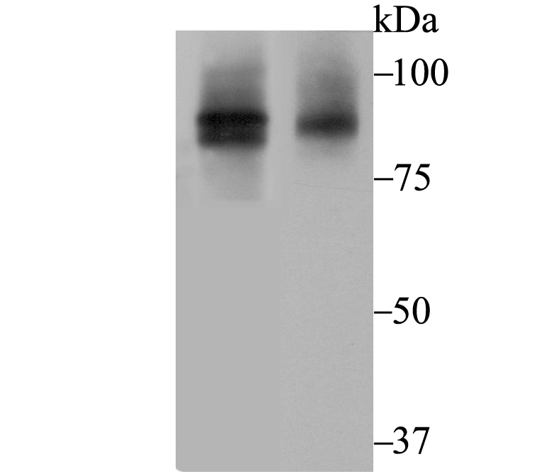 Western blot analysis of Cullin 2 on different lysates with Rabbit anti-Cullin 2 antibody (ET7108-47) at 1/500 dilution.<br />
<br />
Lane 1: PC-3M cell lysate<br />
Lane 2: K562 tissue lysate (20 µg/Lane)<br />
<br />
Lysates/proteins at 20 µg/Lane.<br />
<br />
Predicted band size: 87 kDa<br />
Observed band size: 92 kDa<br />
<br />
Exposure time: 2 minutes;<br />
<br />
10% SDS-PAGE gel.<br />
<br />
Proteins were transferred to a PVDF membrane and blocked with 5% NFDM/TBST for 1 hour at room temperature. The primary antibody (ET7108-47) at 1/500 dilution was used in 5% NFDM/TBST at room temperature for 2 hours. Goat Anti-Rabbit IgG - HRP Secondary Antibody (HA1001) at 1:300,000 dilution was used for 1 hour at room temperature.