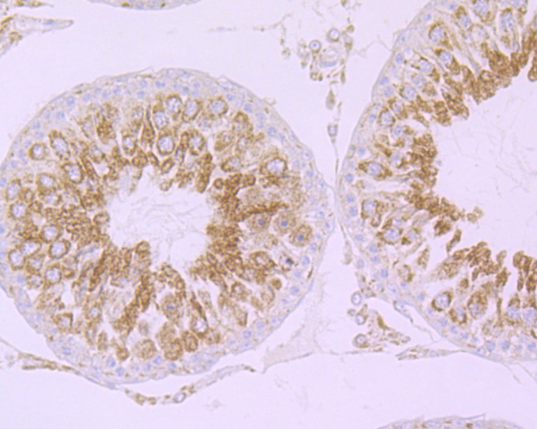 Immunohistochemical analysis of paraffin-embedded rat testis tissue with Rabbit anti-Cullin 2 antibody (ET7108-47) at 1/50 dilution.<br />
<br />
The section was pre-treated using heat mediated antigen retrieval with Tris-EDTA buffer (pH 9.0) for 20 minutes. The tissues were blocked in 1% BSA for 20 minutes at room temperature, washed with ddH2O and PBS, and then probed with the primary antibody (ET7108-47) at 1/50 dilution for 1 hour at room temperature. The detection was performed using an HRP conjugated compact polymer system. DAB was used as the chromogen. Tissues were counterstained with hematoxylin and mounted with DPX.