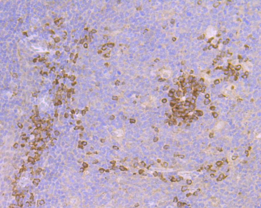 Immunohistochemical analysis of paraffin-embedded human tonsil tissue with Rabbit anti-Cullin 2 antibody (ET7108-47) at 1/50 dilution.<br />
<br />
The section was pre-treated using heat mediated antigen retrieval with Tris-EDTA buffer (pH 9.0) for 20 minutes. The tissues were blocked in 1% BSA for 20 minutes at room temperature, washed with ddH2O and PBS, and then probed with the primary antibody (ET7108-47) at 1/50 dilution for 1 hour at room temperature. The detection was performed using an HRP conjugated compact polymer system. DAB was used as the chromogen. Tissues were counterstained with hematoxylin and mounted with DPX.