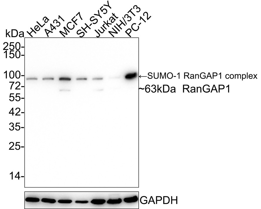 Western blot analysis of RanGAP1 on different lysates with Rabbit anti-RanGAP1 antibody (ET7108-48) at 1/1,000 dilution.<br />
<br />
Lane 1: MCF-7 cell lysates<br />
Lane 2: SiHa cell lysates <br />
Lane 3: 293 cell lysates<br />
<br />
Lysates/proteins at 10 µg/Lane.<br />
<br />
Predicted band size: 64 kDa<br />
Observed band size: 64 kDa<br />
<br />
Exposure time: 2 minutes;<br />
<br />
10% SDS-PAGE gel.<br />
<br />
Proteins were transferred to a PVDF membrane and blocked with 5% NFDM/TBST for 1 hour at room temperature. The primary antibody (ET7108-48) at 1/1,000 dilution was used in 5% NFDM/TBST at room temperature for 2 hours. Goat Anti-Rabbit IgG - HRP Secondary Antibody (HA1001) at 5,000 dilution was used for 1 hour at room temperature.