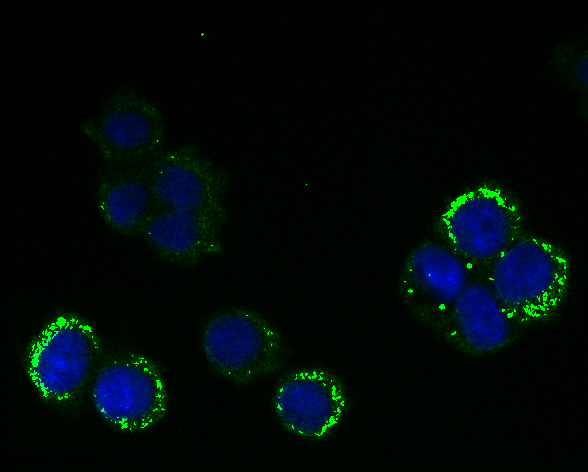 ICC staining RanGAP1 (green) in 293T cells. The nuclear counter stain is DAPI (blue). Cells were fixed in paraformaldehyde, permeabilised with 0.25% Triton X100/PBS.