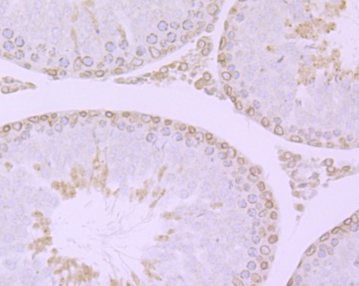Immunohistochemical analysis of paraffin-embedded rat testis tissue with Rabbit anti-RanGAP1 antibody (ET7108-48) at 1/50 dilution.<br />
<br />
The section was pre-treated using heat mediated antigen retrieval with Tris-EDTA buffer (pH 8.0-8.4) for 20 minutes. The tissues were blocked in 1% BSA for 20 minutes at room temperature, washed with ddH2O and PBS, and then probed with the primary antibody (ET7108-48) at 1/50 dilution for 0.5 hour at room temperature. The detection was performed using an HRP conjugated compact polymer system. DAB was used as the chromogen. Tissues were counterstained with hematoxylin and mounted with DPX.