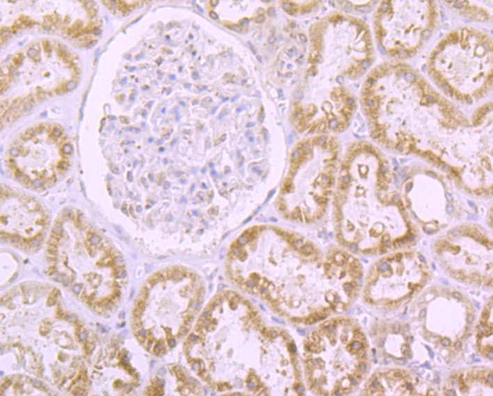 Immunohistochemical analysis of paraffin-embedded human kidney tissue with Rabbit anti-RanGAP1 antibody (ET7108-48) at 1/50 dilution.<br />
<br />
The section was pre-treated using heat mediated antigen retrieval with Tris-EDTA buffer (pH 8.0-8.4) for 20 minutes. The tissues were blocked in 1% BSA for 20 minutes at room temperature, washed with ddH2O and PBS, and then probed with the primary antibody (ET7108-48) at 1/50 dilution for 0.5 hour at room temperature. The detection was performed using an HRP conjugated compact polymer system. DAB was used as the chromogen. Tissues were counterstained with hematoxylin and mounted with DPX.