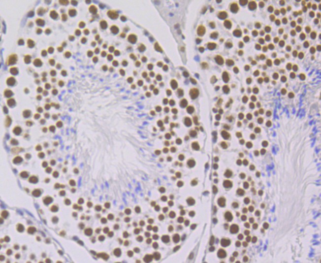 Immunohistochemical analysis of paraffin-embedded mouse testis tissue with Rabbit anti-ILF3 antibody (ET7108-49) at 1/50 dilution.<br />
<br />
The section was pre-treated using heat mediated antigen retrieval with Tris-EDTA buffer (pH 9.0) for 20 minutes. The tissues were blocked in 1% BSA for 20 minutes at room temperature, washed with ddH2O and PBS, and then probed with the primary antibody (ET7108-49) at 1/50 dilution for 0.5 hour at room temperature. The detection was performed using an HRP conjugated compact polymer system. DAB was used as the chromogen. Tissues were counterstained with hematoxylin and mounted with DPX.