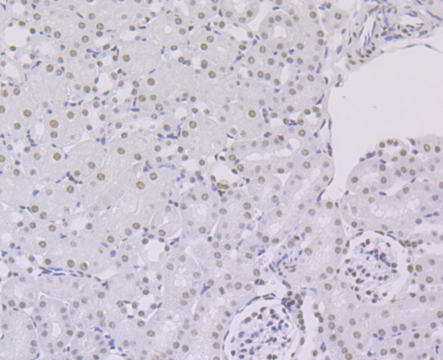 Immunohistochemical analysis of paraffin-embedded mouse kidney tissue with Rabbit anti-ILF3 antibody (ET7108-49) at 1/50 dilution.<br />
<br />
The section was pre-treated using heat mediated antigen retrieval with Tris-EDTA buffer (pH 9.0) for 20 minutes. The tissues were blocked in 1% BSA for 20 minutes at room temperature, washed with ddH2O and PBS, and then probed with the primary antibody (ET7108-49) at 1/50 dilution for 0.5 hour at room temperature. The detection was performed using an HRP conjugated compact polymer system. DAB was used as the chromogen. Tissues were counterstained with hematoxylin and mounted with DPX.