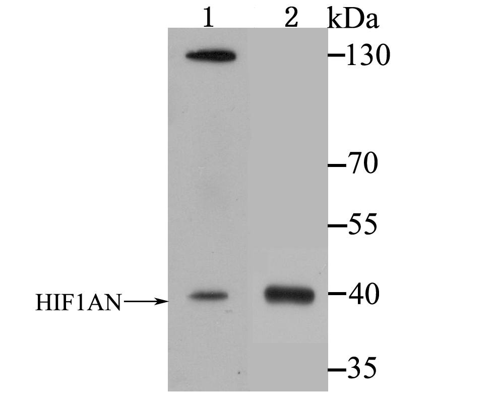 Western blot analysis of HIF1AN on A549 and Jurkat cell lysates using anti-HIF1AN antibody at 1/1,000 dilution.