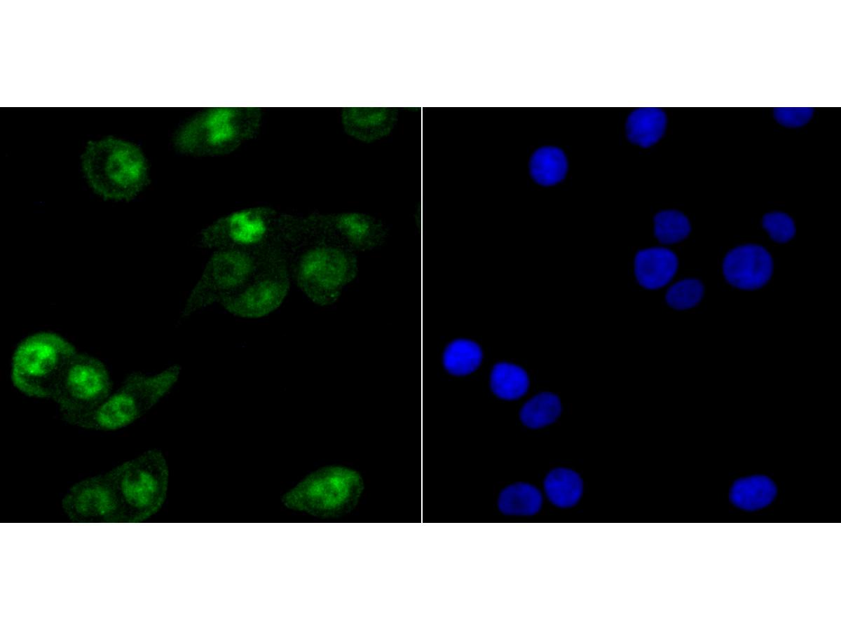 ICC staining HIF1AN in LOVO cells (green). The nuclear counter stain is DAPI (blue). Cells were fixed in paraformaldehyde, permeabilised with 0.25% Triton X100/PBS.