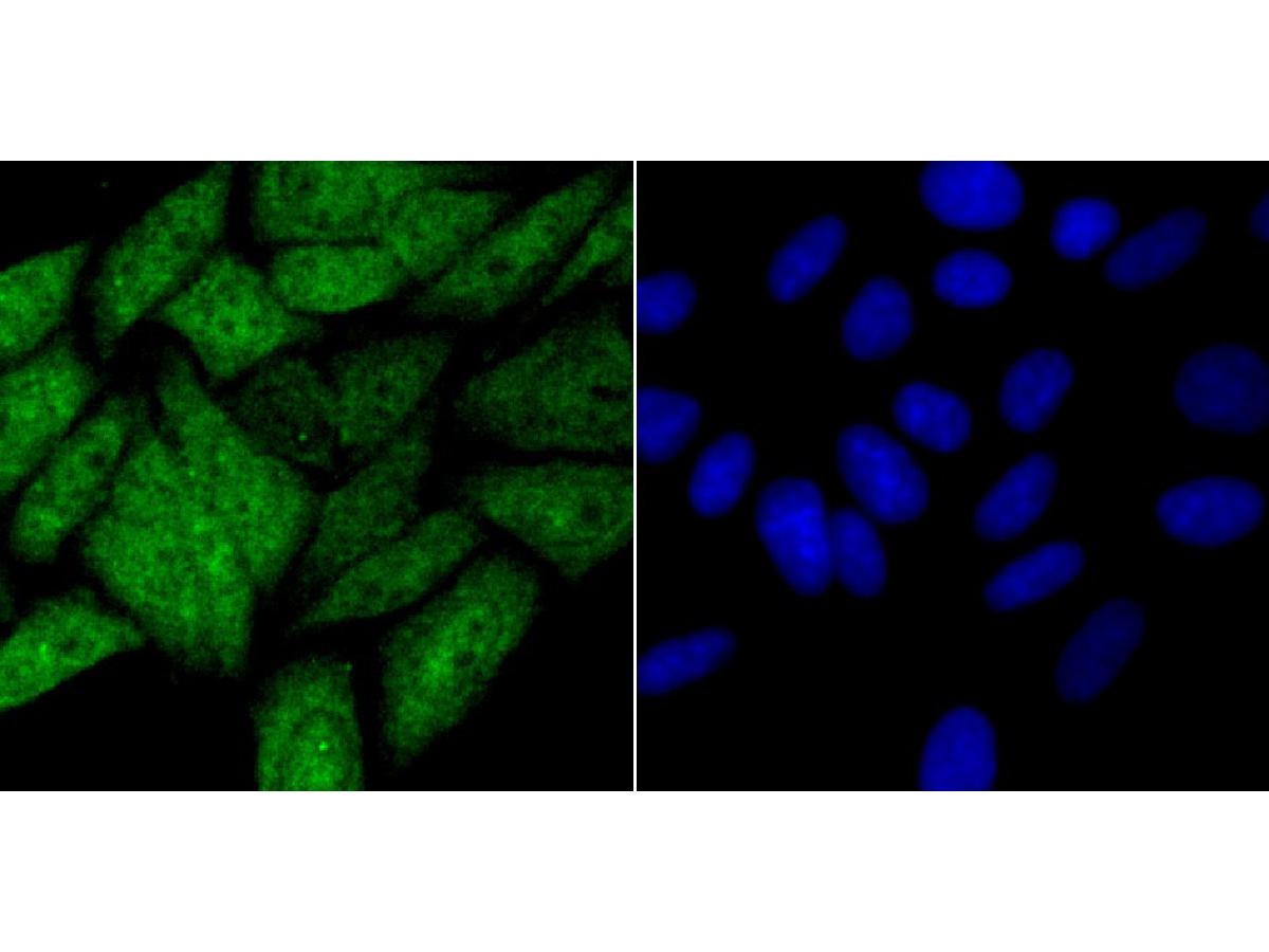 Immunocytochemistry analysis of SiHa cells labeling HIF1AN with Rabbit anti-HIF1AN antibody (ET7108-50) at 1/50 dilution.<br />
<br />
Cells were fixed in 4% paraformaldehyde for 10 minutes at 37 ℃, permeabilized with 0.05% Triton X-100 in PBS for 20 minutes, and then blocked with 2% negative goat serum for 30 minutes at room temperature. Cells were then incubated with Rabbit anti-HIF1AN antibody (ET7108-50) at 1/50 dilution in 2% negative goat serum overnight at 4 ℃. Alexa Fluor®488 conjugate-Goat anti-Rabbit IgG was used as the secondary antibody at 1/1,000 dilution. Nuclear DNA was labelled in blue with DAPI.