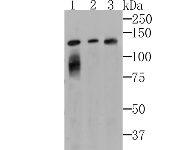 Western blot analysis of Lipin 1 on different lysates with Rabbit anti-Lipin 1 antibody (ET7108-51) at 1/500 dilution.<br />
<br />
Line 1: K562 cell lysates <br />
Line 2: SH-SY-5Y cell lysates <br />
Line 3: Mouse lung tissue lysates(20 µg/Lane)<br />
<br />
Lysates/proteins at 10 µg/Lane.<br />
<br />
Predicted band size:  98 kDa<br />
Observed band size: 130 kDa<br />
<br />
Exposure time: 2 minutes;<br />
<br />
6% SDS-PAGE gel.<br />
<br />
Proteins were transferred to a PVDF membrane and blocked with 5% NFDM/TBST for 1 hour at room temperature. The primary antibody (ET7108-51) at 1/500 dilution was used in 5% NFDM/TBST at room temperature for 2 hours. Goat Anti-Rabbit IgG - HRP Secondary Antibody (HA1001) at 5,000 dilution was used for 1 hour at room temperature.