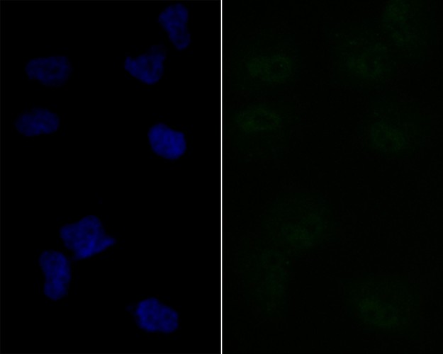 Immunocytochemistry analysis of HUVEC cells labeling Lipin 1 with Rabbit anti-Lipin 1 antibody (ET7108-51) at 1/50 dilution.<br />
<br />
Cells were fixed in 4% paraformaldehyde for 10 minutes at 37 ℃, permeabilized with 0.05% Triton X-100 in PBS for 20 minutes, and then blocked with 2% negative goat serum for 30 minutes at room temperature. Cells were then incubated with Rabbit anti-Lipin 1 antibody (ET7108-51) at 1/50 dilution in 2% negative goat serum overnight at 4 ℃. Alexa Fluor®488 conjugate-Goat anti-Rabbit IgG was used as the secondary antibody at 1/1,000 dilution. Nuclear DNA was labelled in blue with DAPI.