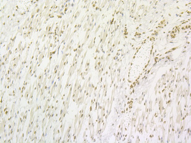 Immunohistochemical analysis of paraffin-embedded human skeletal muscle tissue with Rabbit anti-Lipin 1 antibody (ET7108-51) at 1/50 dilution.<br />
<br />
The section was pre-treated using heat mediated antigen retrieval with Tris-EDTA buffer (pH 8.0-8.4) for 20 minutes. The tissues were blocked in 1% BSA for 20 minutes at room temperature, washed with ddH2O and PBS, and then probed with the primary antibody (ET7108-51) at 1/50 dilution for 0.5 hour at room temperature. The detection was performed using an HRP conjugated compact polymer system. DAB was used as the chromogen. Tissues were counterstained with hematoxylin and mounted with DPX.
