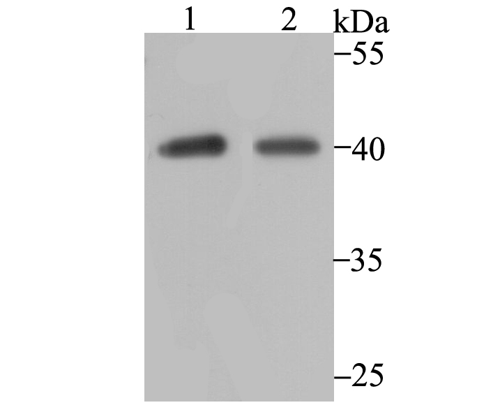 Western blot analysis of P2Y6 on different lysates with Rabbit anti-P2Y6 antibody (ET7108-52) at 1/1,000 dilution.<br />
<br />
Line 1: SK-Br-3 cell lysates <br />
Line 2: A549 cell lysates <br />
<br />
Lysates/proteins at 10 µg/Lane.<br />
<br />
Predicted band size:  36 kDa<br />
Observed band size: 40 kDa<br />
<br />
Exposure time: 2 minutes;<br />
<br />
10% SDS-PAGE gel.<br />
<br />
Proteins were transferred to a PVDF membrane and blocked with 5% NFDM/TBST for 1 hour at room temperature. The primary antibody (ET7108-52) at 1/1,000 dilution was used in 5% NFDM/TBST at room temperature for 2 hours. Goat Anti-Rabbit IgG - HRP Secondary Antibody (HA1001) at 5,000 dilution was used for 1 hour at room temperature.