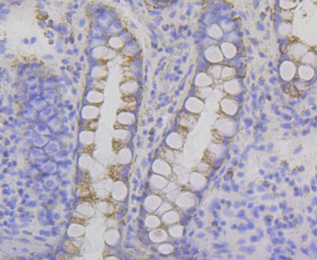 Immunohistochemical analysis of paraffin-embedded human colon tissue with Rabbit anti-P2Y6 antibody (ET7108-52) at 1/50 dilution.<br />
<br />
The section was pre-treated using heat mediated antigen retrieval with Tris-EDTA buffer (pH 9.0) for 20 minutes. The tissues were blocked in 1% BSA for 20 minutes at room temperature, washed with ddH2O and PBS, and then probed with the primary antibody (ET7108-52) at 1/50 dilution for 0.5 hour at room temperature. The detection was performed using an HRP conjugated compact polymer system. DAB was used as the chromogen. Tissues were counterstained with hematoxylin and mounted with DPX.