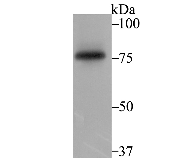 Western blot analysis of SENP1 on K562 cell lysates with Rabbit anti-SENP1 antibody (ET7108-53) at 1/1,000 dilution.<br />
<br />
Lysates/proteins at 20 µg/Lane.<br />
<br />
Predicted band size: 73 kDa<br />
Observed band size: 75 kDa<br />
<br />
Exposure time: 2 minutes;<br />
<br />
8% SDS-PAGE gel.<br />
<br />
Proteins were transferred to a PVDF membrane and blocked with 5% NFDM/TBST for 1 hour at room temperature. The primary antibody (ET7108-53) at 1/1,000 dilution was used in 5% NFDM/TBST at room temperature for 2 hours. Goat Anti-Rabbit IgG - HRP Secondary Antibody (HA1001) at 1:200,000 dilution was used for 1 hour at room temperature.
