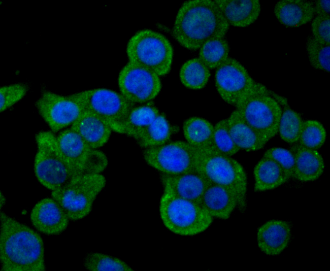 ICC staining SENP1 in LOVO cells (green). The nuclear counter stain is DAPI (blue). Cells were fixed in paraformaldehyde, permeabilised with 0.25% Triton X100/PBS.