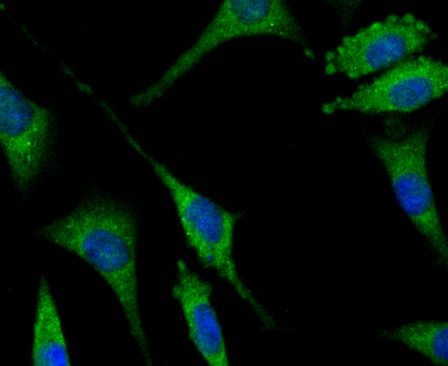 ICC staining SENP1 in SH-SY-5Y cells (green). The nuclear counter stain is DAPI (blue). Cells were fixed in paraformaldehyde, permeabilised with 0.25% Triton X100/PBS.