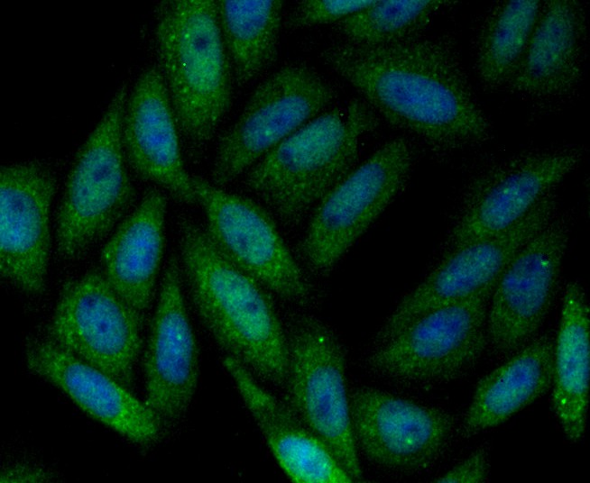 ICC staining SENP1 in SiHa cells (green). The nuclear counter stain is DAPI (blue). Cells were fixed in paraformaldehyde, permeabilised with 0.25% Triton X100/PBS.