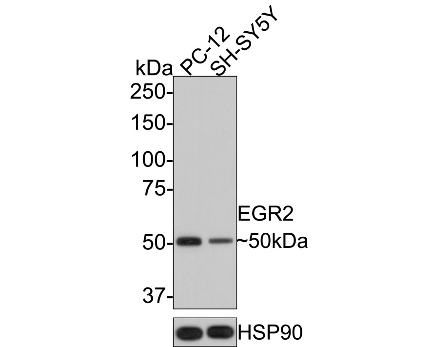 Western blot analysis of EGR2 on different lysates. Proteins were transferred to a PVDF membrane and blocked with 5% BSA in PBS for 1 hour at room temperature. The primary antibody (ET7108-57, 1/500) was used in 5% BSA at room temperature for 2 hours. Goat Anti-Rabbit IgG - HRP Secondary Antibody (HA1001) at 1:200,000 dilution was used for 1 hour at room temperature.<br />
Positive control: <br />
Lane 1: MCF-7 cell lysate<br />
Lane 2: SH-SY5Y cell lysate