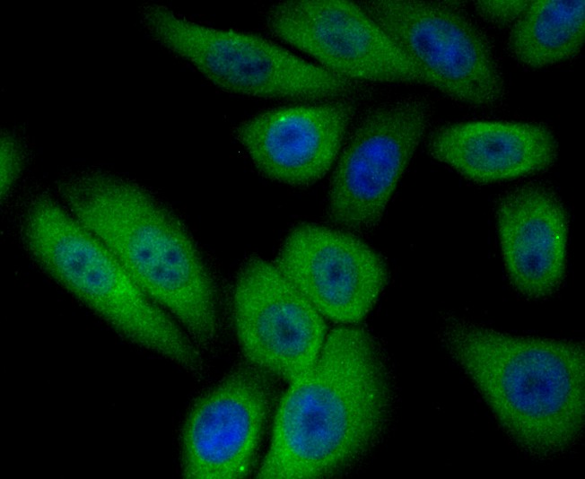 ICC staining PIST in HepG2 cells (green). The nuclear counter stain is DAPI (blue). Cells were fixed in paraformaldehyde, permeabilised with 0.25% Triton X100/PBS.