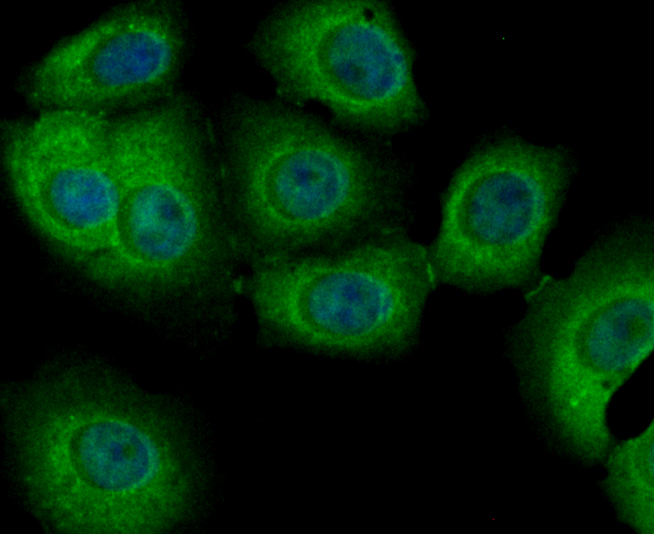 ICC staining PIST in MCF-7 cells (green). The nuclear counter stain is DAPI (blue). Cells were fixed in paraformaldehyde, permeabilised with 0.25% Triton X100/PBS.