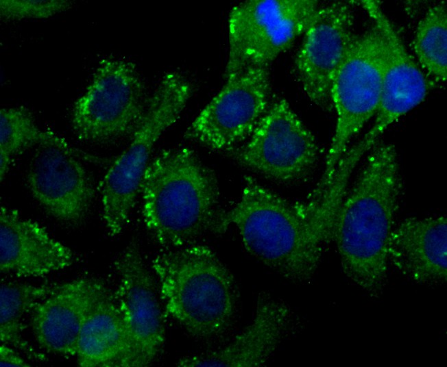 ICC staining PIST in SKOV-3 cells (green). The nuclear counter stain is DAPI (blue). Cells were fixed in paraformaldehyde, permeabilised with 0.25% Triton X100/PBS.