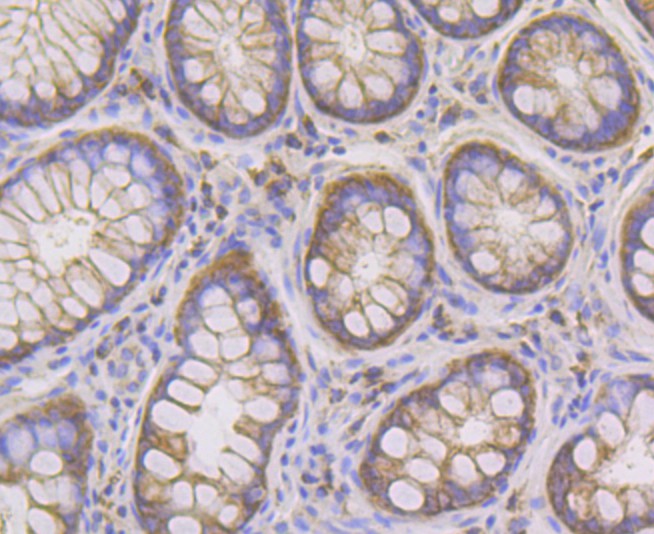 Immunohistochemical analysis of paraffin-embedded human colon tissue using anti-PIST antibody. Counter stained with hematoxylin.