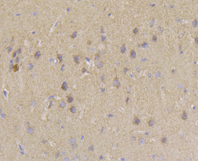 Immunohistochemical analysis of paraffin-embedded mouse brain tissue using anti-PIST antibody. Counter stained with hematoxylin.