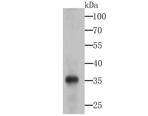 Western blot analysis of Gemin 1 on SiHa cell lysates using anti-Gemin 1 at 1/500 dilution.