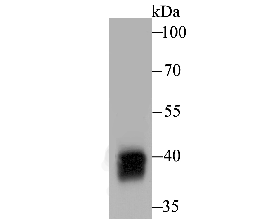Western blot analysis of Alcohol Dehydrogenase on rat liver tissue lysates with Rabbit anti-Alcohol Dehydrogenase antibody (ET7108-64) at 1/1,000 dilution.<br />
<br />
Lysates/proteins at 20 µg/Lane.<br />
<br />
Predicted band size:40 kDa<br />
Observed band size: 40 kDa<br />
<br />
Exposure time: 2 minutes;<br />
<br />
10% SDS-PAGE gel.<br />
<br />
Proteins were transferred to a PVDF membrane and blocked with 5% NFDM/TBST for 1 hour at room temperature. The primary antibody (ET7108-64) at 1/1,000 dilution was used in 5% NFDM/TBST at room temperature for 2 hours. Goat Anti-Rabbit IgG - HRP Secondary Antibody (HA1001) at 1:5,000 dilution was used for 1 hour at room temperature.