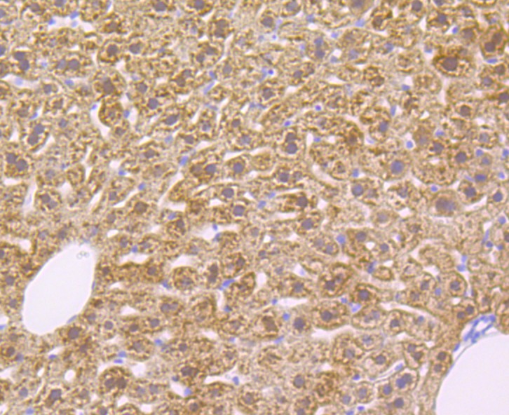 Immunohistochemical analysis of paraffin-embedded mouse liver tissue  with Rabbit anti-Alcohol Dehydrogenase antibody (ET7108-64) at 1/50 dilution.<br />
<br />
The section was pre-treated using heat mediated antigen retrieval with Tris-EDTA buffer (pH 8.0-8.4) for 20 minutes. The tissues were blocked in 1% BSA for 20 minutes at room temperature, washed with ddH2O and PBS, and then probed with the primary antibody (ET7108-64) at 1/50 dilution for 0.5 hour at room temperature. The detection was performed using an HRP conjugated compact polymer system. DAB was used as the chromogen. Tissues were counterstained with hematoxylin and mounted with DPX.