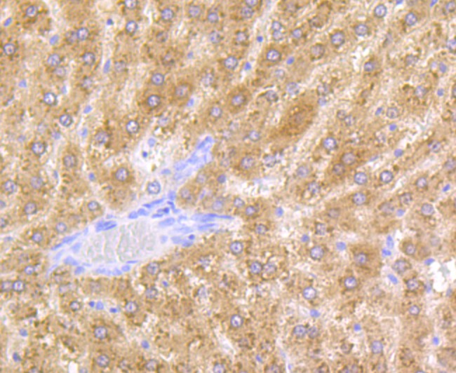 Immunohistochemical analysis of paraffin-embedded rat liver tissue  with Rabbit anti-Alcohol Dehydrogenase antibody (ET7108-64) at 1/50 dilution.<br />
<br />
The section was pre-treated using heat mediated antigen retrieval with Tris-EDTA buffer (pH 8.0-8.4) for 20 minutes. The tissues were blocked in 1% BSA for 20 minutes at room temperature, washed with ddH2O and PBS, and then probed with the primary antibody (ET7108-64) at 1/50 dilution for 0.5 hour at room temperature. The detection was performed using an HRP conjugated compact polymer system. DAB was used as the chromogen. Tissues were counterstained with hematoxylin and mounted with DPX.