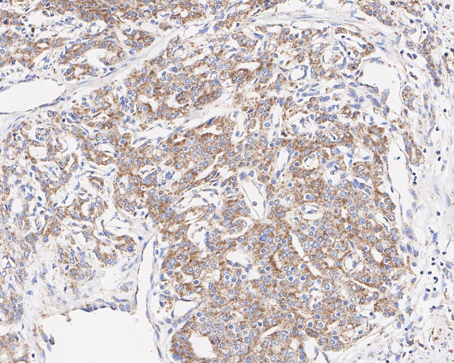 Immunohistochemical analysis of paraffin-embedded human kidney tissue using anti-GRIM19 antibody. Counter stained with hematoxylin.