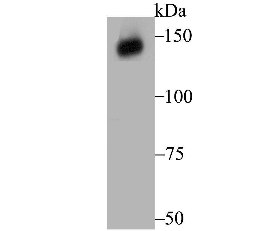 Western blot analysis of Xanthine Oxidase on human kidney tissue lysates. Proteins were transferred to a PVDF membrane and blocked with 5% BSA in PBS for 1 hour at room temperature. The primary antibody (ET7108-69, 1/500) was used in 5% BSA at room temperature for 2 hours. Goat Anti-Rabbit IgG - HRP Secondary Antibody (HA1001) at 1:200,000 dilution was used for 1 hour at room temperature.