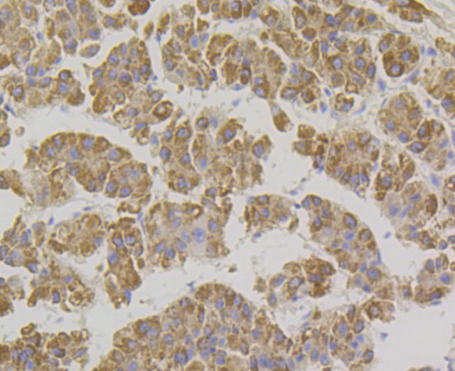 Immunohistochemical analysis of paraffin-embedded human liver tissue using anti-Xanthine Oxidase antibody. The section was pre-treated using heat mediated antigen retrieval with Tris-EDTA buffer (pH 9.0) for 20 minutes.The tissues were blocked in 1% BSA for 30 minutes at room temperature, washed with ddH2O and PBS, and then probed with the primary antibody (ET7108-69, 1/50) for 30 minutes at room temperature. The detection was performed using an HRP conjugated compact polymer system. DAB was used as the chromogen. Tissues were counterstained with hematoxylin and mounted with DPX.