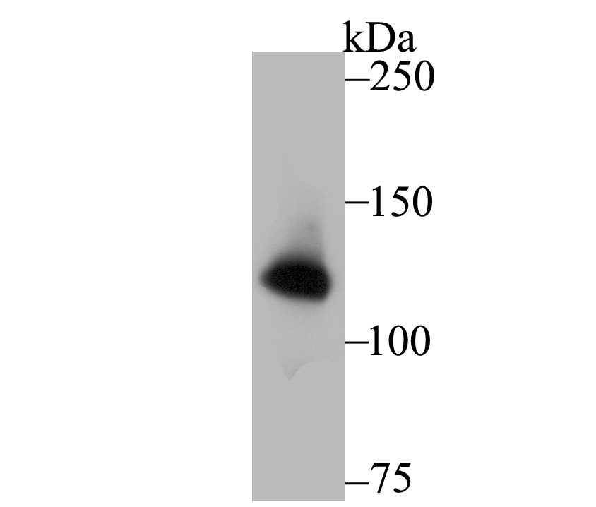 Western blot analysis of hUPF1 on PC-3M cell lysates. Proteins were transferred to a PVDF membrane and blocked with 5% BSA in PBS for 1 hour at room temperature. The primary antibody (ET7108-70, 1/500) was used in 5% BSA at room temperature for 2 hours. Goat Anti-Rabbit IgG - HRP Secondary Antibody (HA1001) at 1:200,000 dilution was used for 1 hour at room temperature.