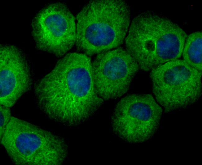 ICC staining of hUPF1 in A431 cells (green). Formalin fixed cells were permeabilized with 0.1% Triton X-100 in TBS for 10 minutes at room temperature and blocked with 1% Blocker BSA for 15 minutes at room temperature. Cells were probed with the primary antibody (ET7108-70, 1/50) for 1 hour at room temperature, washed with PBS. Alexa Fluor®488 Goat anti-Rabbit IgG was used as the secondary antibody at 1/1,000 dilution. The nuclear counter stain is DAPI (blue).