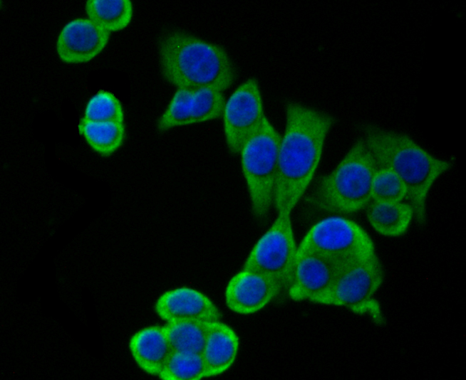 ICC staining of hUPF1 in LOVO cells (green). Formalin fixed cells were permeabilized with 0.1% Triton X-100 in TBS for 10 minutes at room temperature and blocked with 1% Blocker BSA for 15 minutes at room temperature. Cells were probed with the primary antibody (ET7108-70, 1/50) for 1 hour at room temperature, washed with PBS. Alexa Fluor®488 Goat anti-Rabbit IgG was used as the secondary antibody at 1/1,000 dilution. The nuclear counter stain is DAPI (blue).