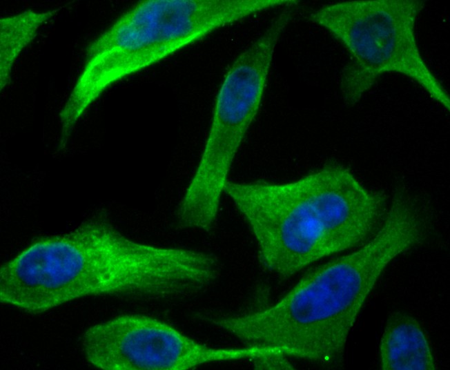 ICC staining of hUPF1 in PC-3M cells (green). Formalin fixed cells were permeabilized with 0.1% Triton X-100 in TBS for 10 minutes at room temperature and blocked with 1% Blocker BSA for 15 minutes at room temperature. Cells were probed with the primary antibody (ET7108-70, 1/50) for 1 hour at room temperature, washed with PBS. Alexa Fluor®488 Goat anti-Rabbit IgG was used as the secondary antibody at 1/1,000 dilution. The nuclear counter stain is DAPI (blue).