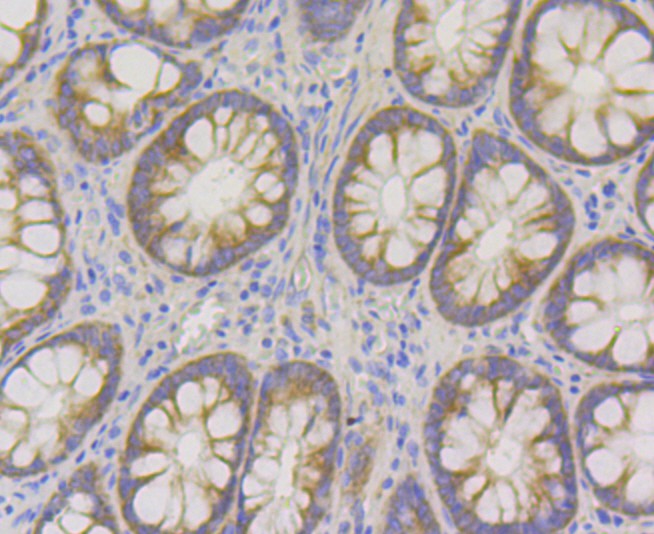 Immunohistochemical analysis of paraffin-embedded human colon tissue using anti-hUPF1 antibody. The section was pre-treated using heat mediated antigen retrieval with Tris-EDTA buffer (pH 8.0-8.4) for 20 minutes.The tissues were blocked in 5% BSA for 30 minutes at room temperature, washed with ddH2O and PBS, and then probed with the primary antibody (ET7108-70, 1/50) for 30 minutes at room temperature. The detection was performed using an HRP conjugated compact polymer system. DAB was used as the chromogen. Tissues were counterstained with hematoxylin and mounted with DPX.