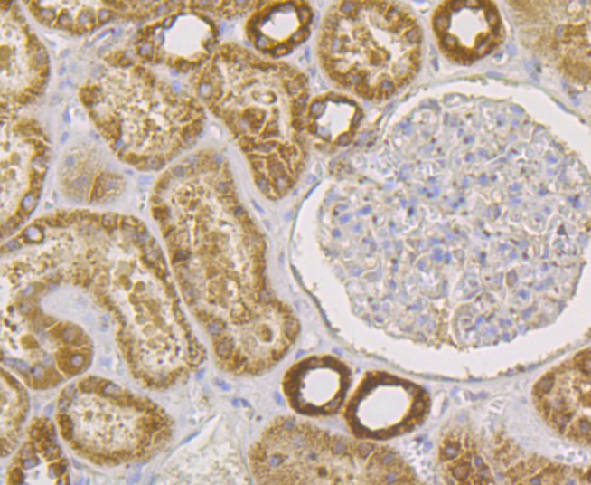 Immunohistochemical analysis of paraffin-embedded human kidney tissue using anti-hUPF1 antibody. The section was pre-treated using heat mediated antigen retrieval with Tris-EDTA buffer (pH 8.0-8.4) for 20 minutes.The tissues were blocked in 5% BSA for 30 minutes at room temperature, washed with ddH2O and PBS, and then probed with the primary antibody (ET7108-70, 1/50) for 30 minutes at room temperature. The detection was performed using an HRP conjugated compact polymer system. DAB was used as the chromogen. Tissues were counterstained with hematoxylin and mounted with DPX.