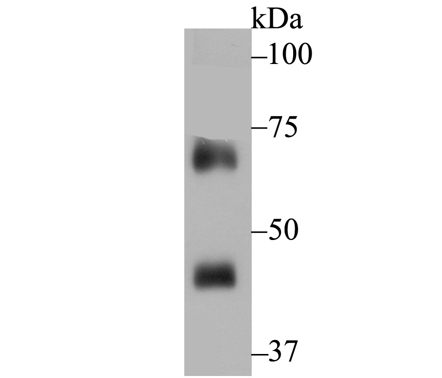 Western blot analysis of NOXA2 on rat spleen tissue lysates. Proteins were transferred to a PVDF membrane and blocked with 5% BSA in PBS for 1 hour at room temperature. The primary antibody (ET7108-72, 1/500) was used in 5% BSA at room temperature for 2 hours. Goat Anti-Rabbit IgG - HRP Secondary Antibody (HA1001) at 1:40,000 dilution was used for 1 hour at room temperature.