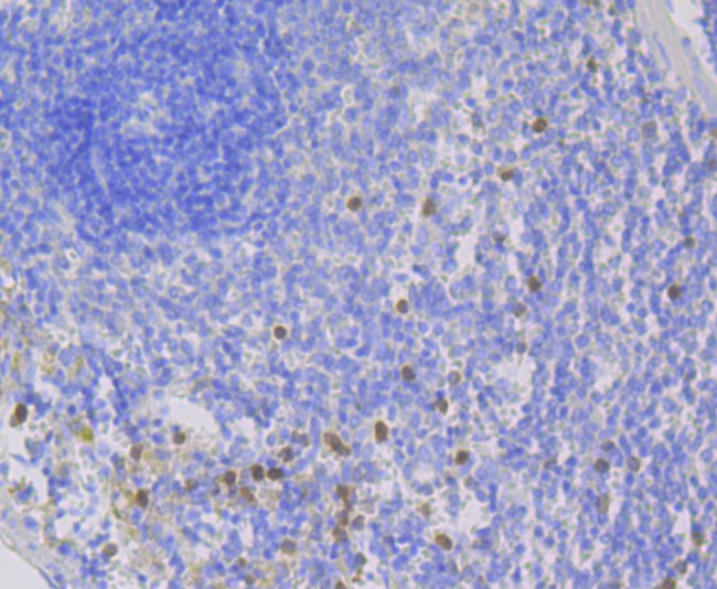 Immunohistochemical analysis of paraffin-embedded rat spleen tissue using anti-NOXA2 antibody. The section was pre-treated using heat mediated antigen retrieval with Tris-EDTA buffer (pH 8.0-8.4) for 20 minutes.The tissues were blocked in 5% BSA for 30 minutes at room temperature, washed with ddH2O and PBS, and then probed with the primary antibody (ET7108-72, 1/50) for 30 minutes at room temperature. The detection was performed using an HRP conjugated compact polymer system. DAB was used as the chromogen. Tissues were counterstained with hematoxylin and mounted with DPX.
